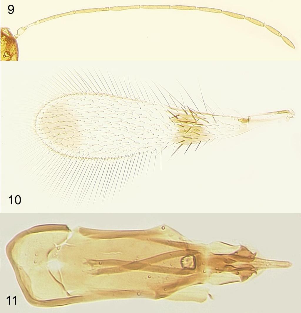 Journal of Insect Biodiversity 5(14): 1-8, 2017 Figures 9 11. Polynema dikobraz sp. nov. (male, paratype): 9, antenna; 10, fore wing; 11, genitalia. the genus Agalmopolynema Ogloblin, 1960, A.