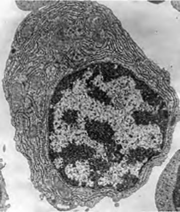 (c) The electronmicrograph below shows a plasma cell. Some structures inside this cell have been labelled.