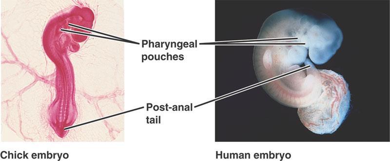 The Pharyngeal Pouches will shape parts
