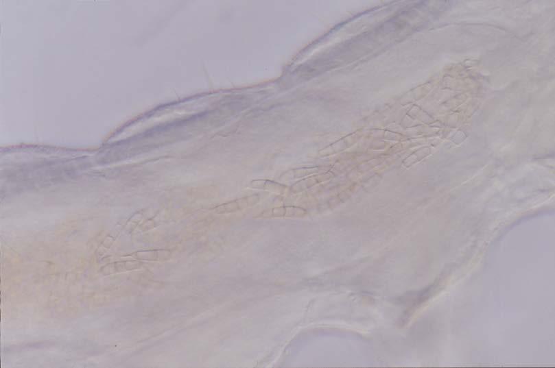 Conidia of F. culmorum (Fc) were palatable and no toxic for Collembola.