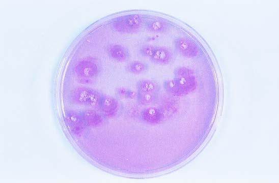 Protaphorura armata Folsomia candida Back Petri dishes with Trichoderma colonies from faecal pellets