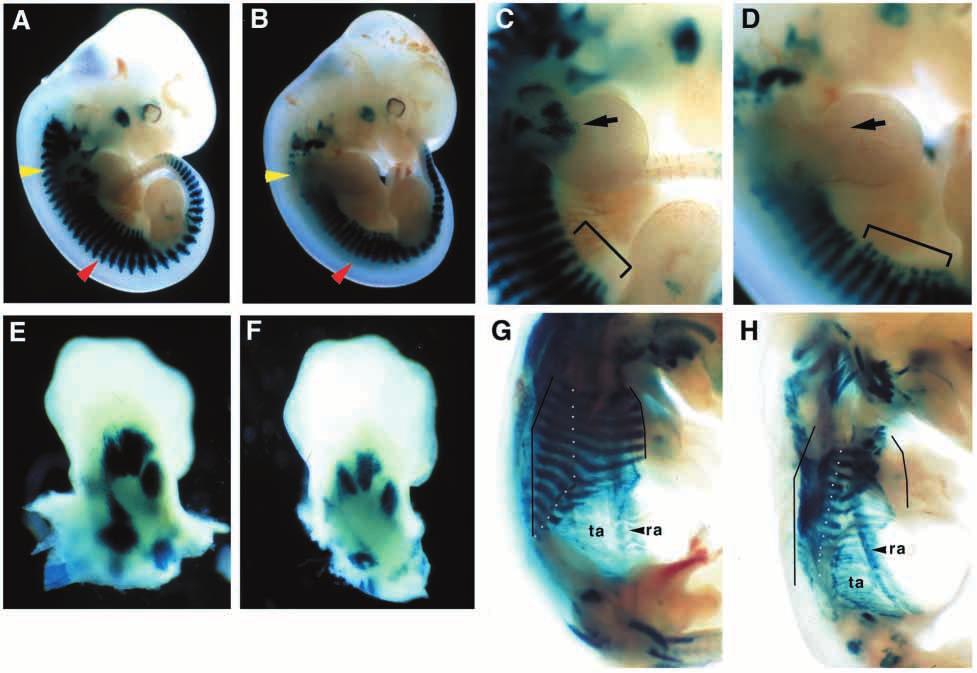 Regulation of hypaxial myotome by Paraxis 5221 Fig. 2. Formation of hypaxial muscles is delayed in the paraxis / embryos.