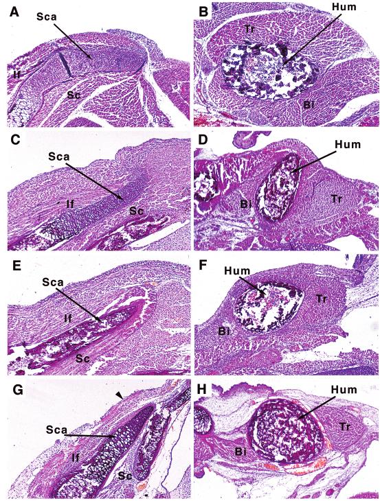 Regulation of hypaxial myotome by Paraxis 5225 Fig. 9. Myf5 / /paraxis / neonatal mice display reduction of appendicular muscle.