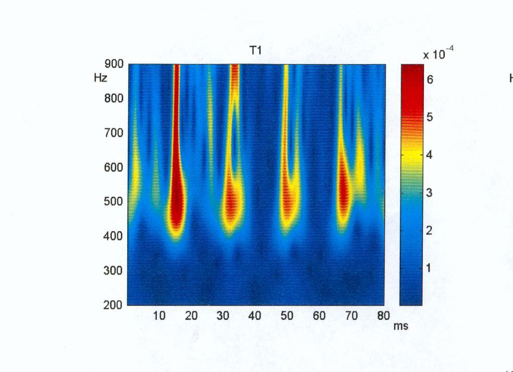 Vibration analysis of defect bear-rings J.-O.