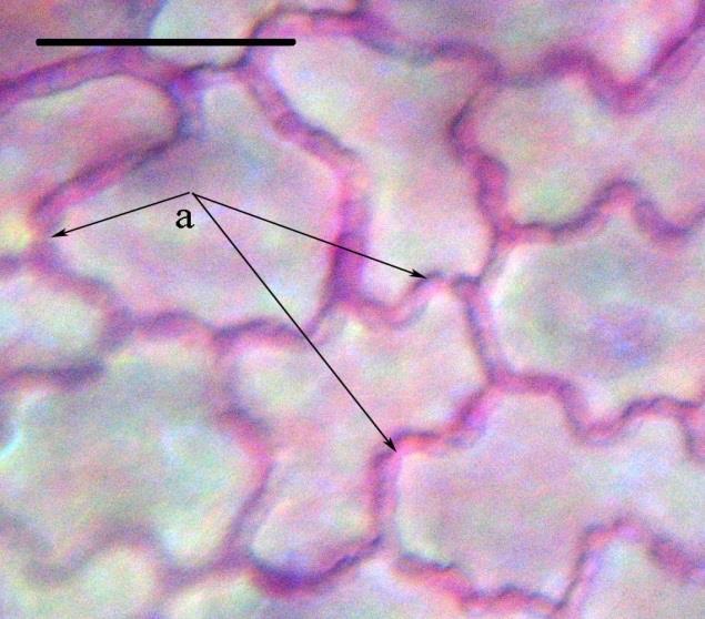 13-a); - diacytic-type stomata are present in both epidermises (Toma et al., 2000), thus the foliar blade is amphistomatic (Fig. 12-b and Fig.
