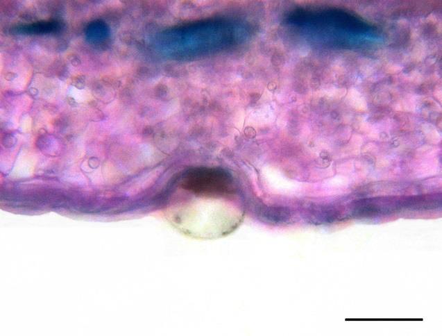Fig. 21. Lower epidermis, secretory hair with pluricellular gland. Fig. 23. Secretory hair with unicellular gland. Fig. 22.