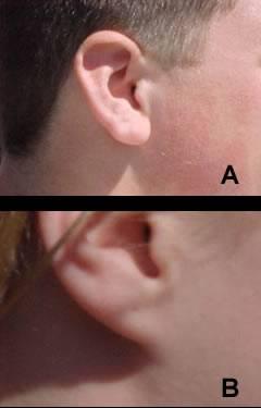 Guided Practice People can have either free or attached earlobes. Free is dominant to attached. What does F represent?
