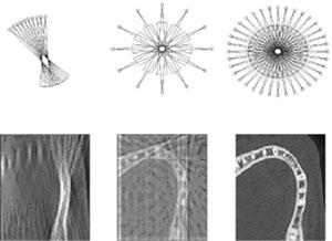 Measurement diversity and photon scarcity In limited- or sparse-angle tomography,