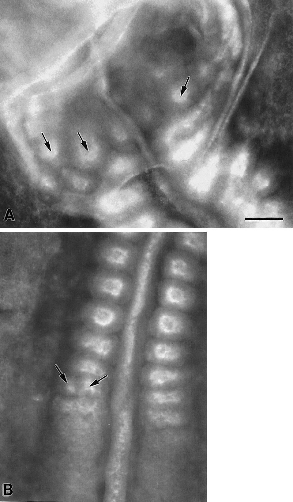 98 Linask et al. FIG. 10. Anomalous somites formed in LiCl-treated embryos. Embryos were immunostained for -catenin after incubation for a 24-h period.