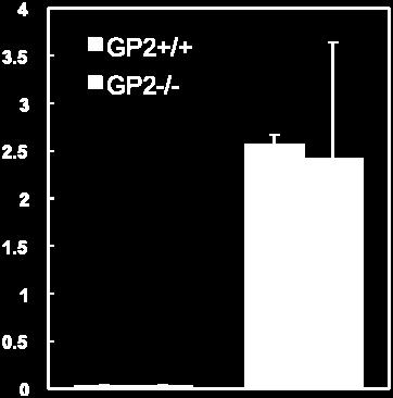 GP2 +/+ and GP2 -/- mice received intraperitoneal injection with 5 x 10 5 CFU of rsalmonella-toxc for systemic immunization.