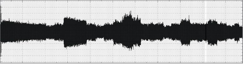 5 Frequency specrum disribuion of filered signal 4, 1/3 [10], 4 10 Hz, 20 Hz, 31.