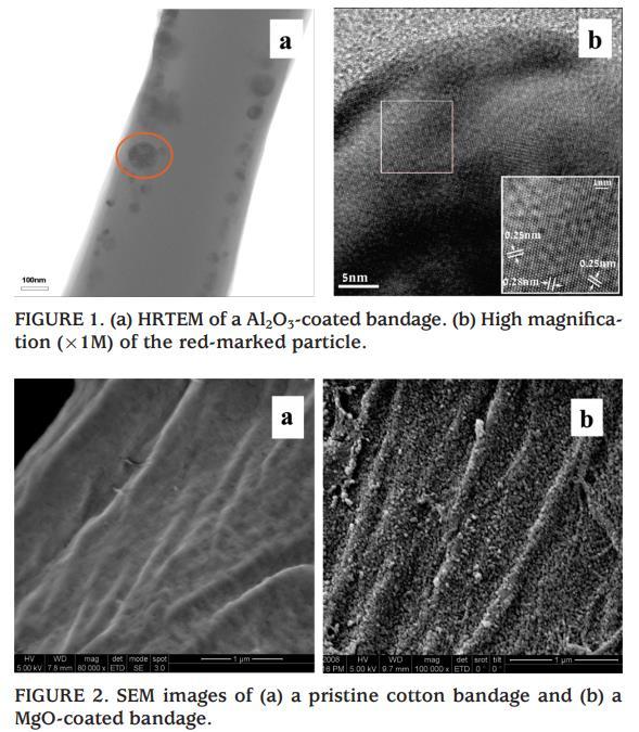 Throwing Stones in situ synthesis and coating with NPs Ultrasound Radiation as a Throwing Stones Technique for the Production of Antibacterial Nanocomposite Textiles Perelshtein, G. Applerot, N.
