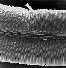Fig. 6. Scanning electron micrograph of epiptygmata, sclerotized vulval projections, on a female Peltamigratus christiei.
