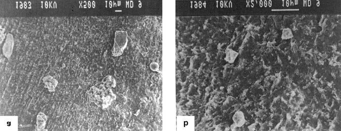 480 Arunkumar Lagashetty et al Figure 5. (a b) SEM of as synthesized MoO 3 PVA composite at low and high magnifications. Table 1.