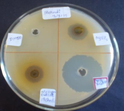 Zone of inhibition of Psidium guajava against E. coli, Pseudomonas aerogenosa, Bacillus subtilis and Proteus vulgaris was 11mm, 8mm, 9mm and 10mm respectively (Table 1).