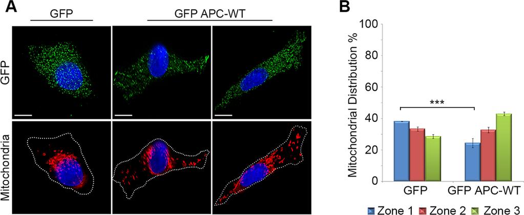FIGURE 3: Reconstitution of wild-type APC in APC-mutant HT-29 cells rescues mitochondrial transport.