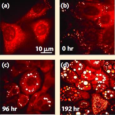 Fig. 2. Growth of lipid droplets in live cells monitored by CARS microscopy. Lipid contrast at 2845 cm 1 was used to visualize lipids without staining.