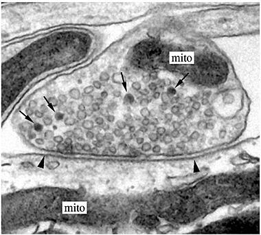 Mitochondrial fission versus