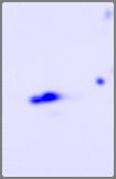 Chrom matography PKC 5 3 1 2 4 + Electrophoresis 1