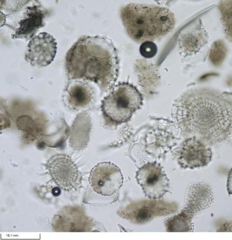 Biogenic silica became scarcer when we drilled deeper, and many cores were barren of radiolarians.