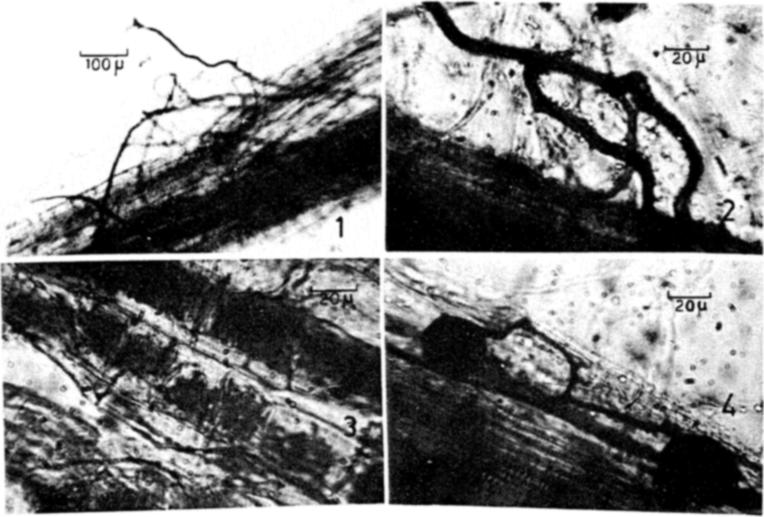 56 M Vijayalakshmi and A S Rao taneously with root infection for 5 replicates, after extraction by the wet-sieving and decanting technique (Gerdemann and Nicolson 1963). 3.