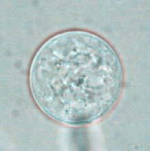 4 µm (G) 16.0 µm (H) 18.
