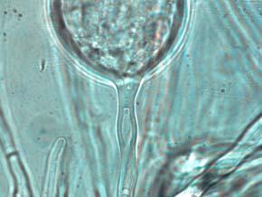 29 Figure 8: Phytophthora ramorum Chlamydospore Septum Development A B C D E F Chlamydospore Septum