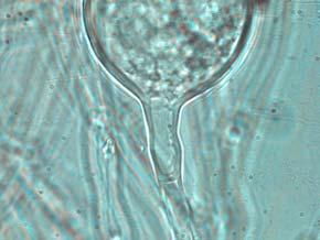 (D- F) Nascent chlamydospores without septa.