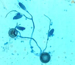 (D) Germinated chlamydospore (left) with two germ tubes ending in