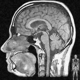 noised and denoised Knee MRI 56 56 Original Brain MRI 56 56 Noisy Brain MRI, σ = 0.