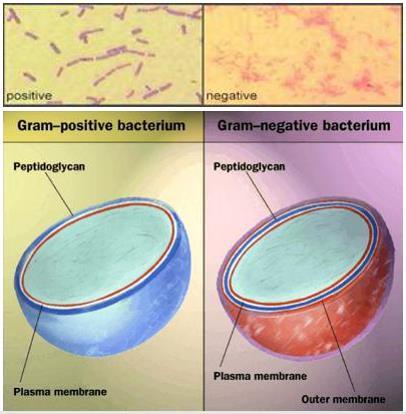 parent cell into two Bacteria cells: one surrounding membrane is Gram +, two surrounding membranes is Gram Note: Bacteria has no histone; Archaea and Eukaryotes have histone bound to the DNA.