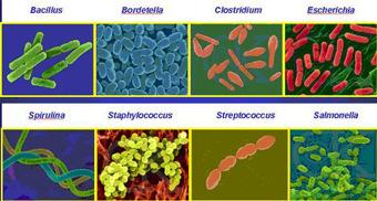 Notes - Microbiology Monera Part 1 Classification - Kingdom moneran is more commonly known as bacteria.