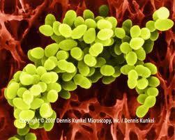 Bacteria are a large domain of