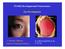 PY4302 Developmental Neuroscience. Eye Development