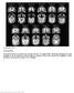 Supplementary Figure 1. Structural MRIs.