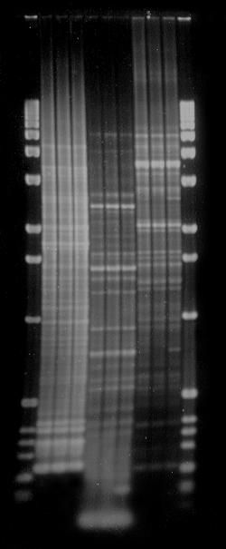 REP PCR Fingerprinting Lanes represent: Strains RL1, ES1, & ES2!
