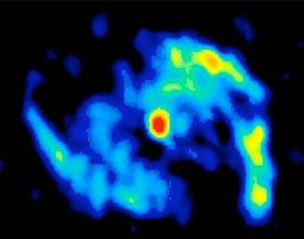 M51 Galaxy Resolved by Submillimeter Array Radio Interferometry Example