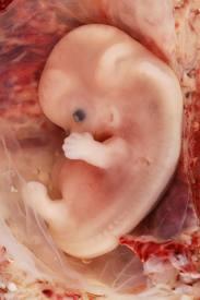 Embryo Support for Evolution- Comparative Embryology An early, pre-birth