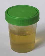 Liquid samples Urine Introduction The trace element content of urine is an indicator for the human health status Task Participation in round robin test for urine samples Sample