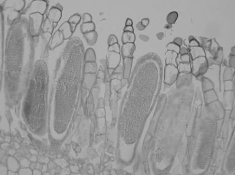 Male Female Station 11 - The Antheridium and Archegonium Examine the prepared slides of longitudinal cross section of a male and female gametophyte tip. Locate the antheridium.
