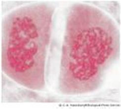 Prophase II Chromosomes