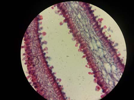 This group is characterized by its reproductive structure called the basidiocarp, a tight bundle of hyphae.