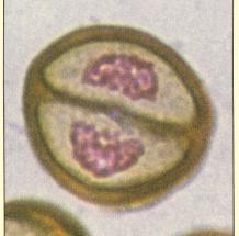 Meiosis and Life Cycles - 10 Meiosis II Prophase II New spindle apparatus is formed in each of the