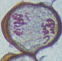 Meiosis and Life Cycles - 9 Anaphase I The homologous chromosomes are separated from each other and pulled toward opposite poles during Anaphase I.
