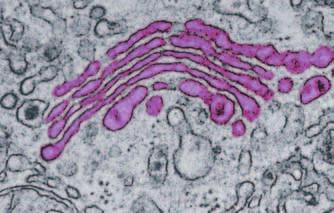 Figure 8 The Golgi complex processes proteins. It moves proteins to where they are needed, including out of the cell.