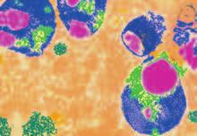 When eukaryotic cells engulf particles, they enclose the particles in vesicles. Lysosomes, shown in blue in Figure 9, bump into the vesicles, shown in purple, and pour enzymes into them.