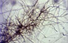 The main body of most fungi is made up of fine, branching, usually colourless threads