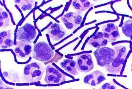 Gram Staining (another method for distinguishing