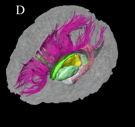 3D axonal structures can be reconstructed based on DTI
