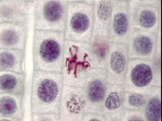 center of the cell Chromosomes